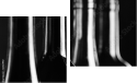 Zweiteiliges Leinwandbild - Diptychon