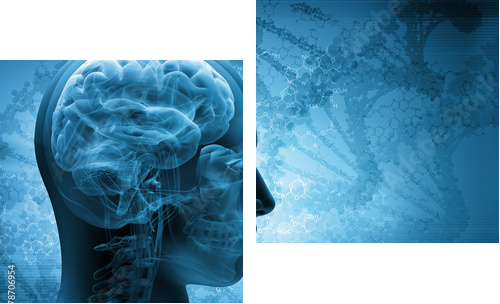 x--ray concept - Zweiteiliges Leinwandbild, Diptychon